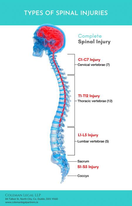 Types of Spinal Injuries Coleman Legal