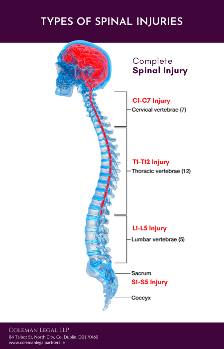 Types of Spinal Injuries Guide Coleman Legal LLP